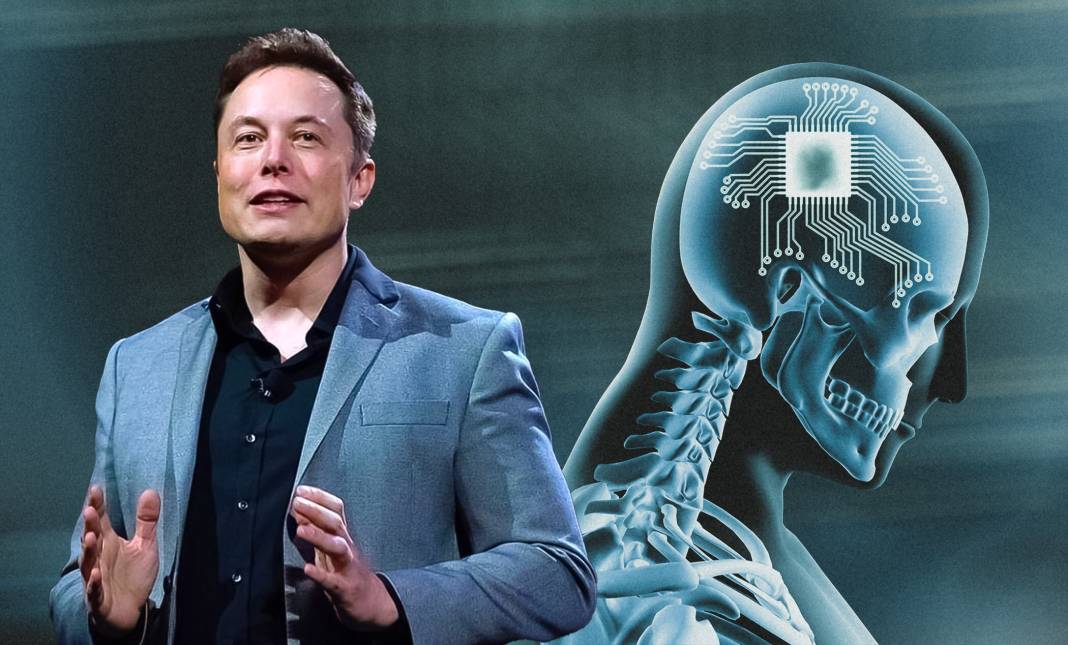 Elon Musk'un projesi Neuralink nedir? Neuralink ne işe yarayacak 8